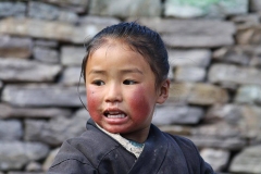 Guance rovinate dal freddo CiaoNamastè Nepal bambina